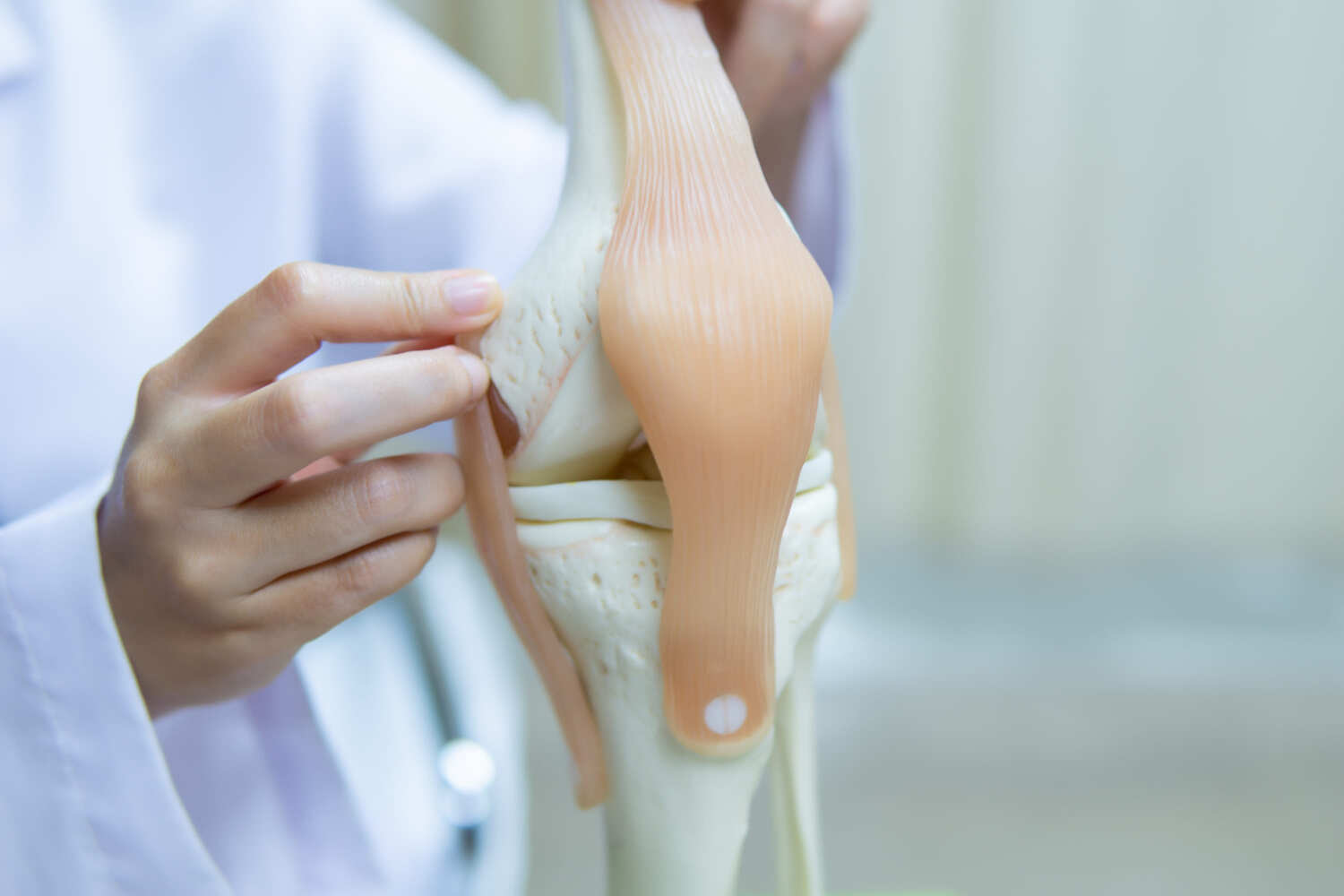 Prótesis de Rodilla en Cuernavaca: Recupera tu Movilidad